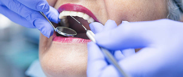 Best Knocked-Out Tooth Emergency  in Tamiami, FL